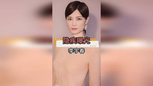 李宇春强直性脊柱炎隐疾,39 岁感情空白