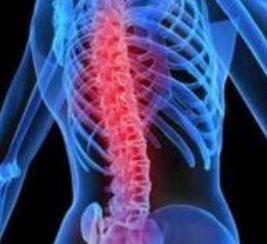 强直性脊柱炎怎样治疗比较好