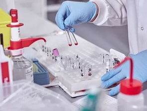 浅谈 不死的癌症 强直性脊柱炎 二