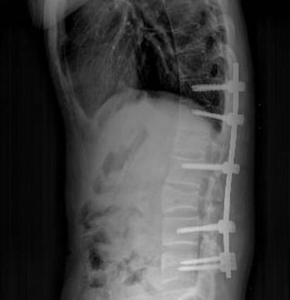 我想平视家人的眼睛说话