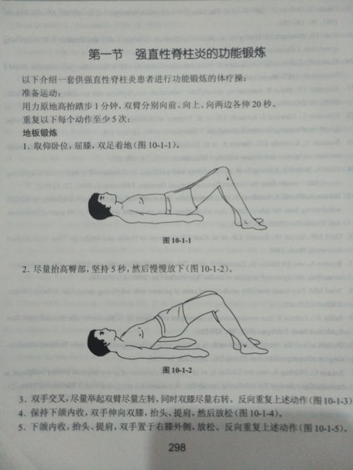 强直性脊柱炎康复及功能锻炼