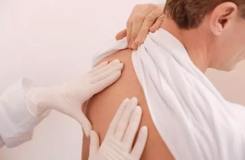 4点关于强直性脊柱炎的危害,快看你占了哪一条