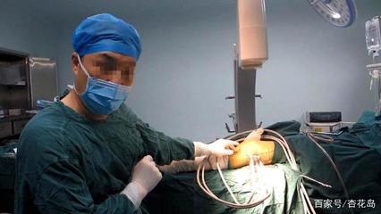 8岁小孩被检查出强直性脊柱炎,这是为什么呢?