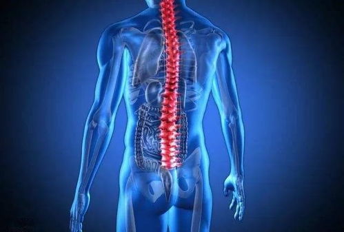 强直性脊柱炎,不要只关注腰背疼不疼