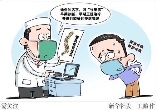 治疗类风湿关节炎等免疫疾病的国产单抗药上市,自动纳入医保