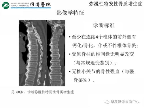脊柱炎性病变的影像诊断思路