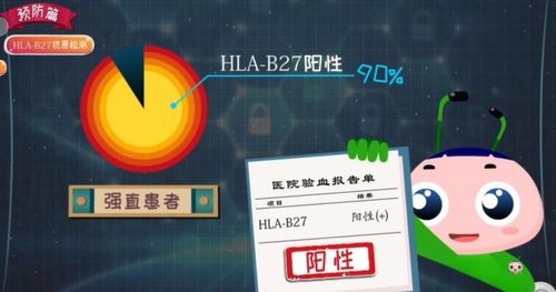 强直性脊柱炎并非 不死的癌症