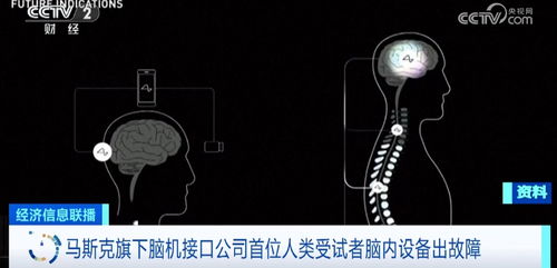 设备脱落 马斯克脑机公司紧急修复