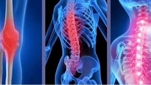 强直性脊柱炎患者的功能锻炼 守护脊柱活动，提升生活质量