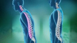 强直性脊柱炎的治疗与自我管理 你必须了解的关键要点